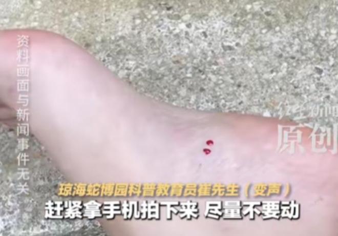 ！医院迷惑操作家属接连发声已成立调查组mg不朽情缘游戏网站游客蛇伤致死后续(图11)